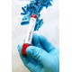 Certificación y Limpieza higinico sanitaria instalación nebulizadores