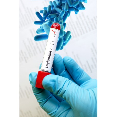 Certificación y Limpieza higinico sanitaria instalación nebulizadores
